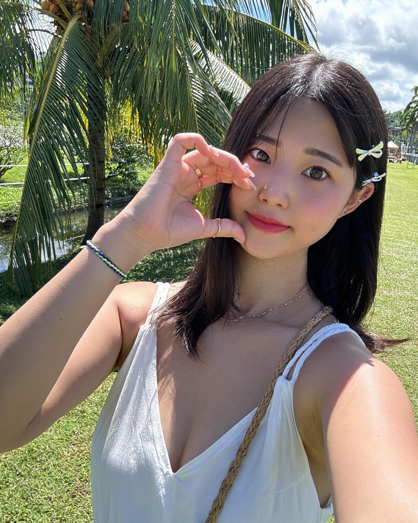 아연 사진